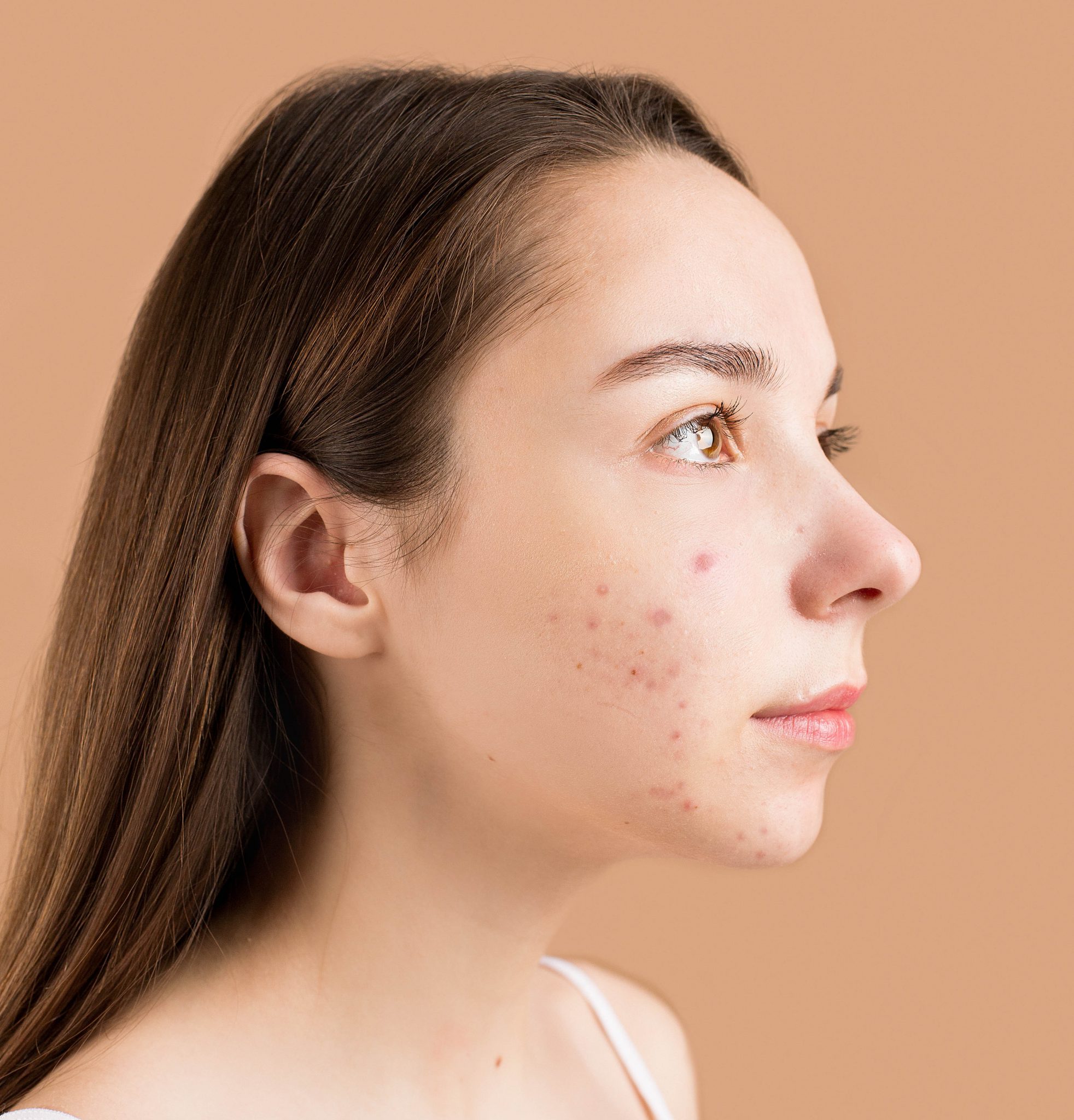 do-you-need-to-see-a-dermatologist-for-that-rash-skin-and-cancer