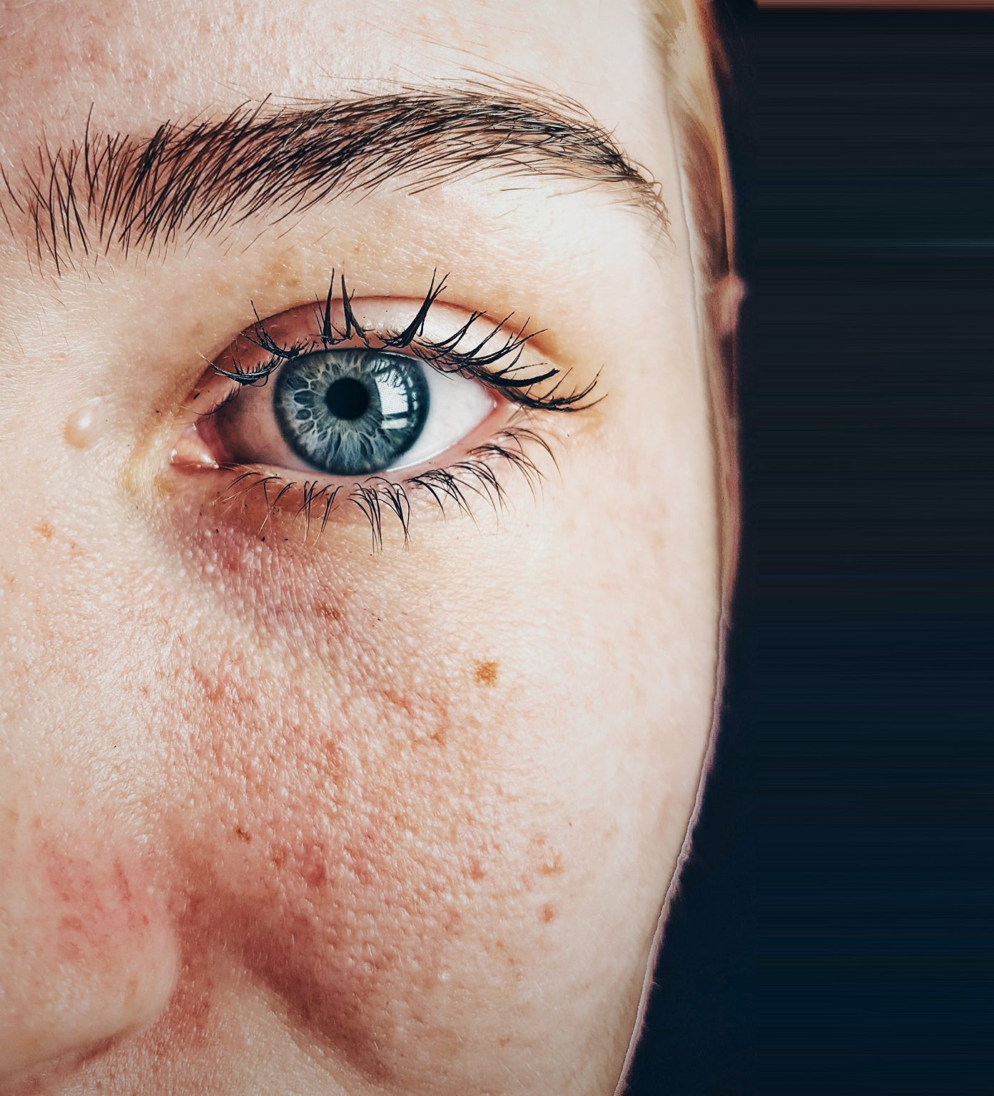 Do You Need To See A Dermatologist For That Rash? Skin And Cancer