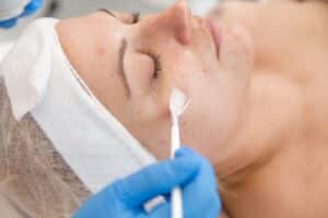 provider spreading a chemical peel on a woman's face