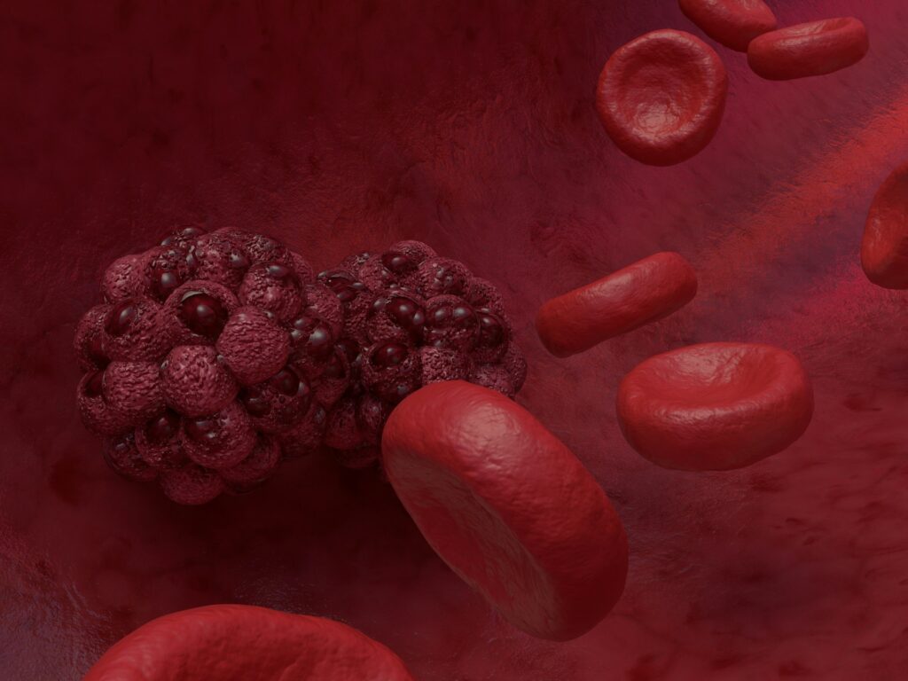 combination therapy